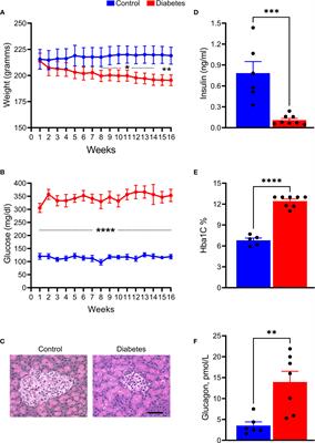 A Novel Tree Shrew Model of Diabetic Retinopathy